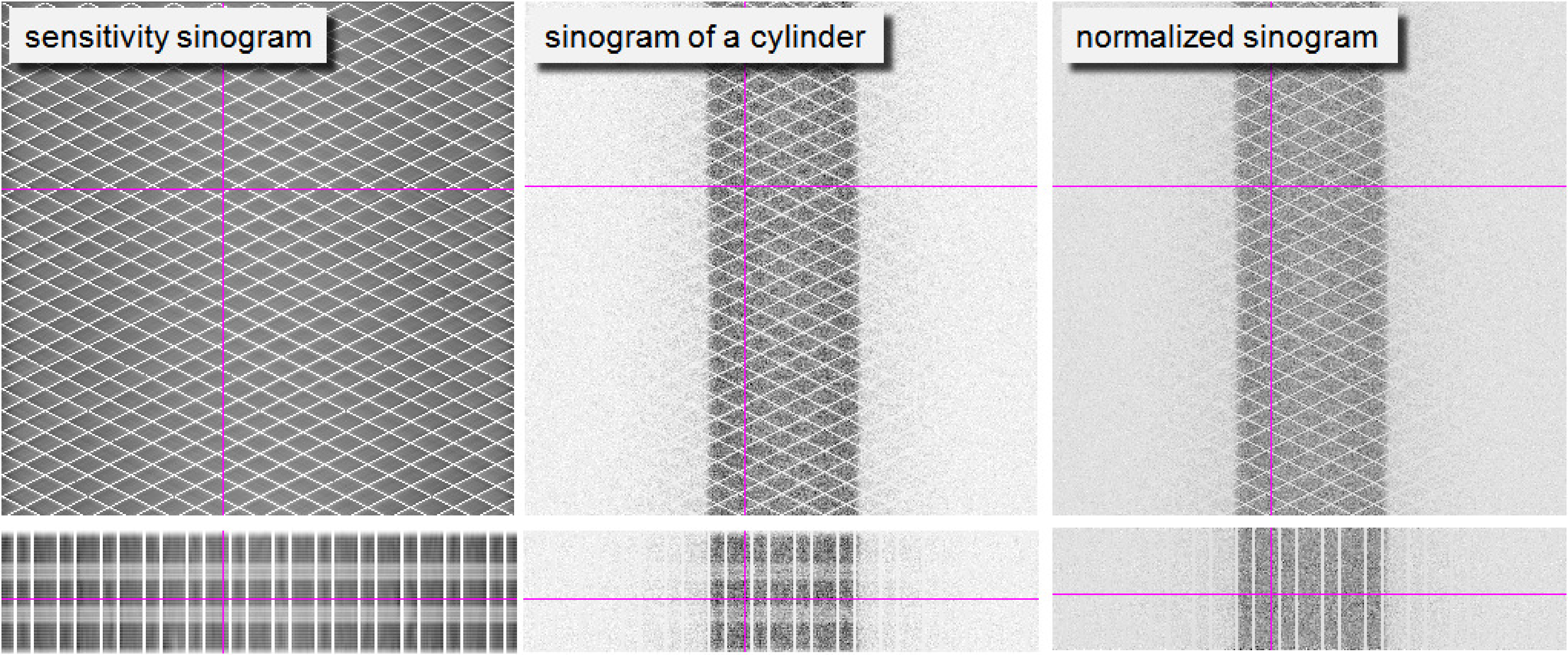 Left: PET sensitivity sinogram. Center: the sinogram of a cylinder filled with a uniform activity. Right: the same sinogram after normalization. The first row are sinograms, the second row projections, the cross-hairs indicate the relative position of both. Because there are small gaps between detector blocks, there is a regular pattern of zero sensitivity projection lines, which are of course not corrected by the normalization.