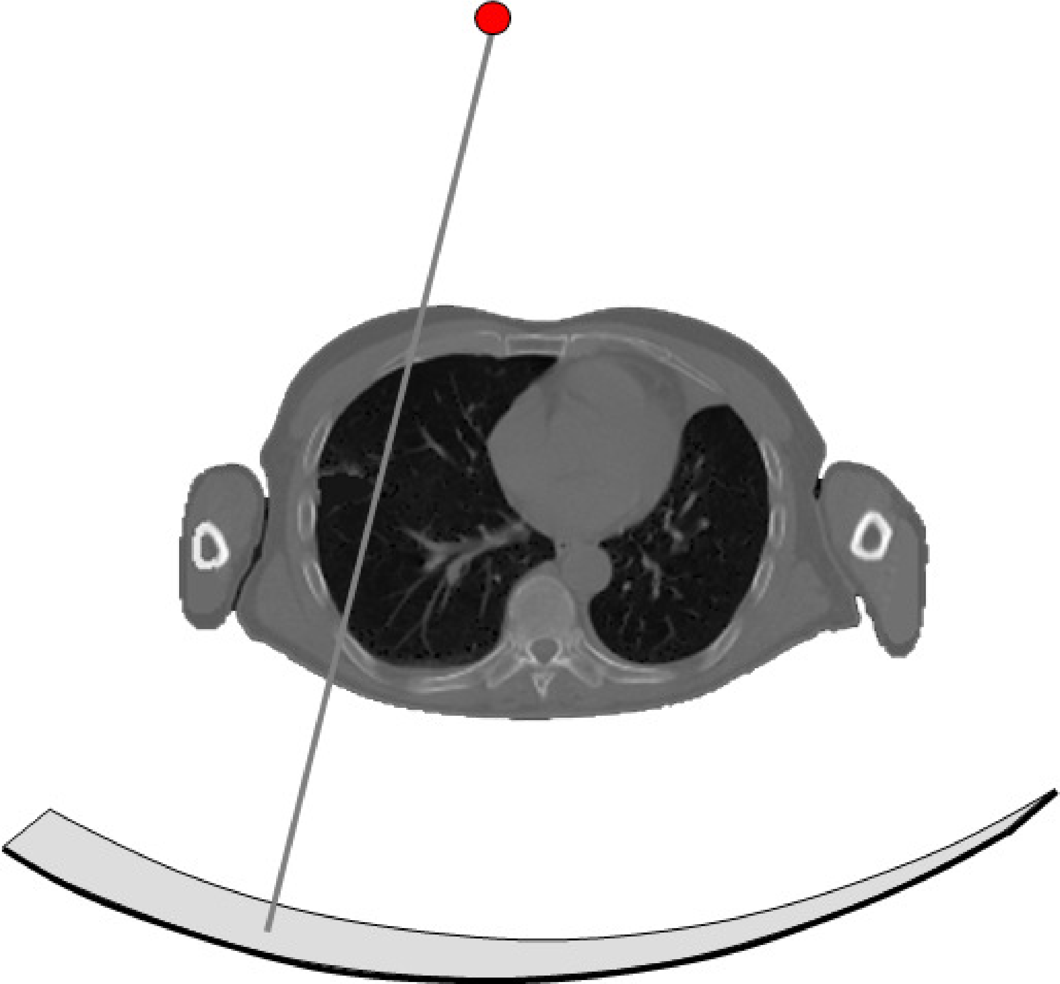 A CT system consists of a collimated X-ray tube and a detector mounted on a rotating gantry. The detector has tens to hundreds of rows, each consisting of about a thousand detector elements