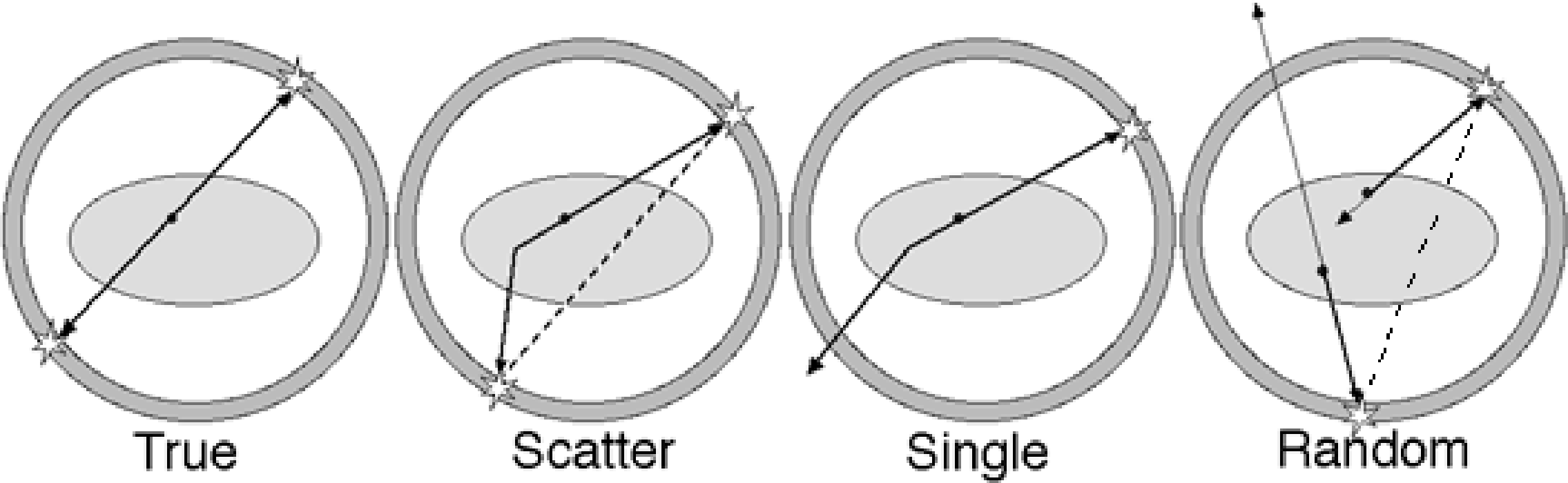 True coincidence, scattered coincidence, single event, random coincidence