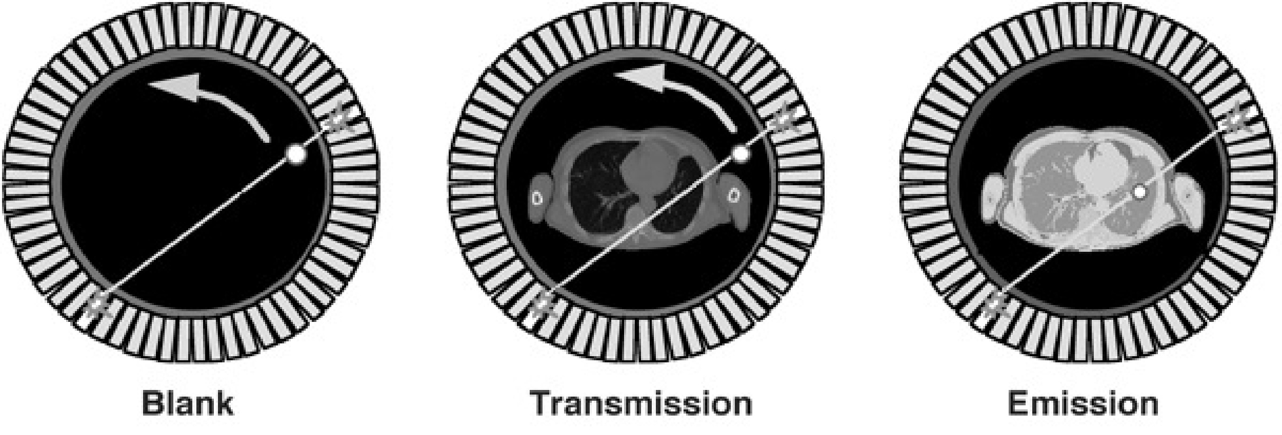 Rotating transmission source in PET. As a reference, a blank scan is acquired daily.