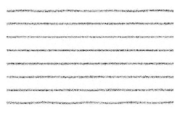Image of a line phantom acquired on a gamma camera with poor linearity correction.