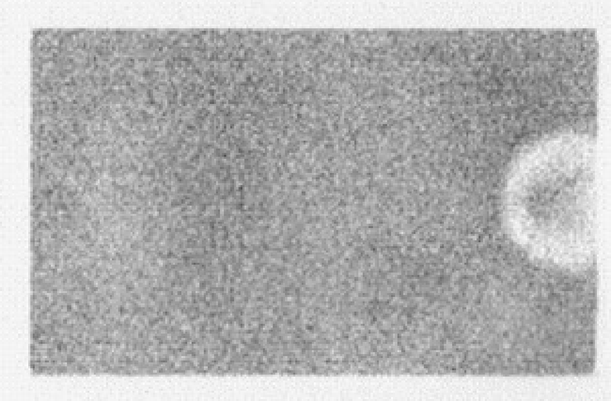 Uniform image acquired on a gamma camera with a dead photomultiplier.