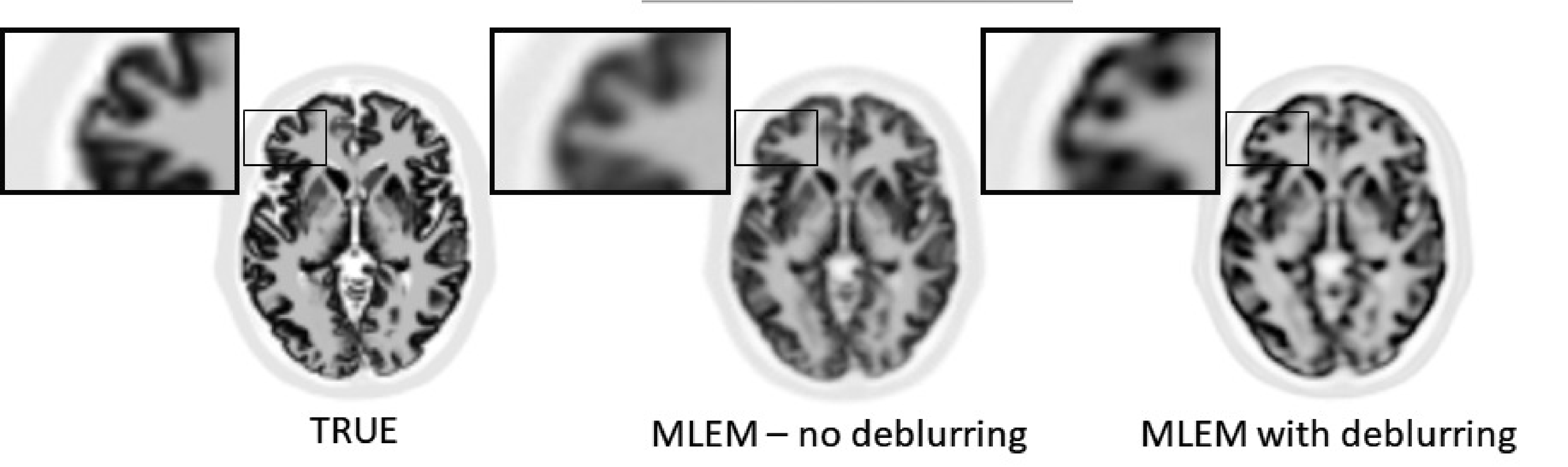 PET simulation without noise but with finite resolution modeling. MLEM with deblurring produced sharper images, but they are clearly different from the ground truth.