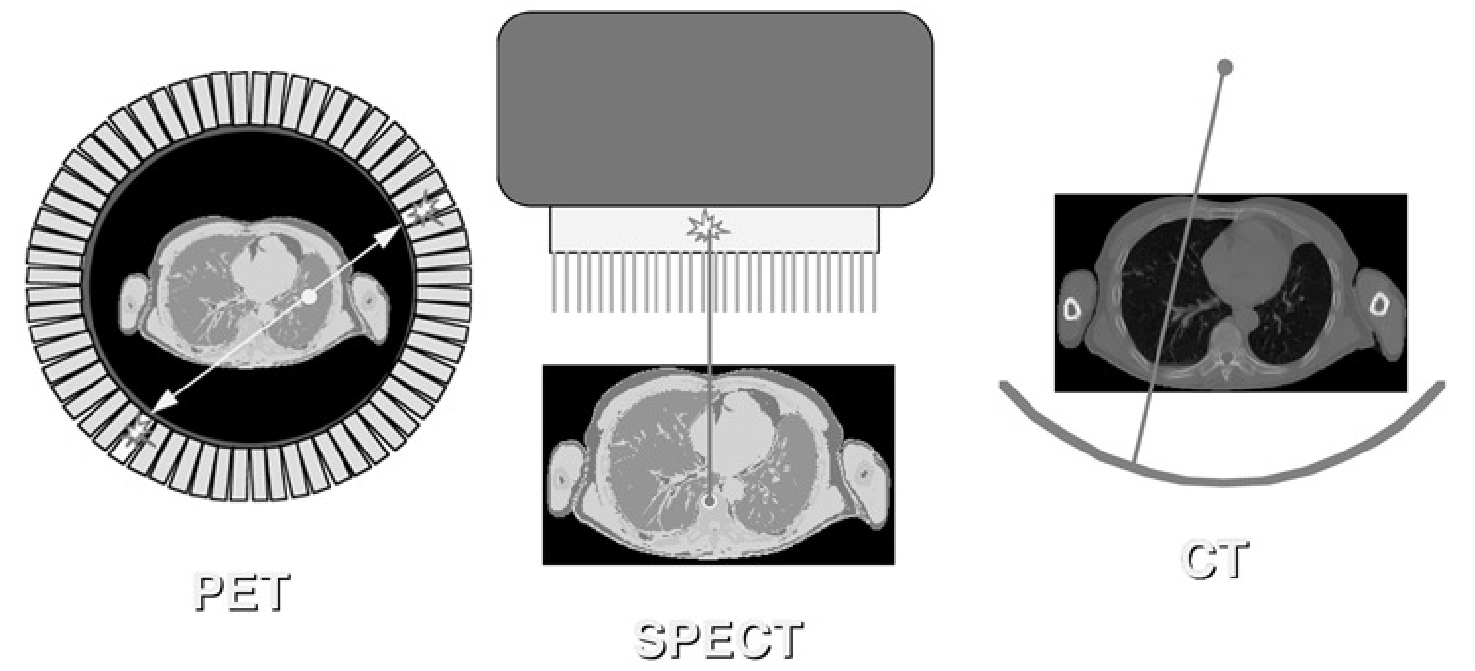 Collimation in the PET camera, the gamma camera (SPECT) and the CT camera.